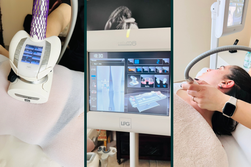 LPG device for massage and body shaping.